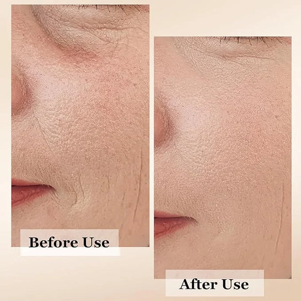 mivida Anti-Aging Super Serum with Retinol, Hyaluronic-Acid, Rosehip Oil, Vitamin C | All-In-One Face Serum For Wrinkles, ...