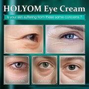 Advanced Eye Cream for Dark Circles - Targeted Solution for Wrinkles, Puffiness, and Firmness - Proven Efficacy with Cynan...