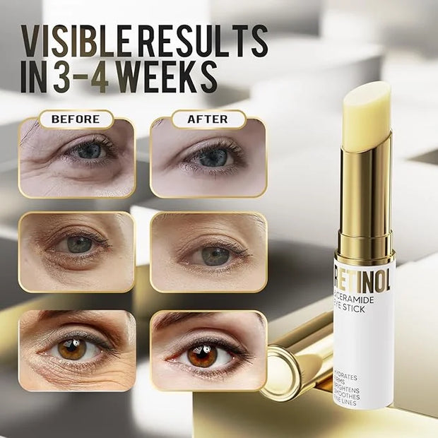Retinol Eye Stick, Eye Cream for Dark Circles and Puffiness, Eye Brightening Cream for Hydration, Wrinkles in 3-4 Weeks, T...