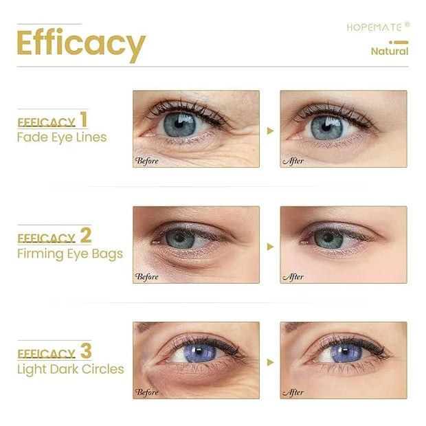 Eye Cream for Dark Circles, Puffiness, and Wrinkles, Improves and Firms eye Skin for Youthful, Refreshed Eyes-Pure Natural...