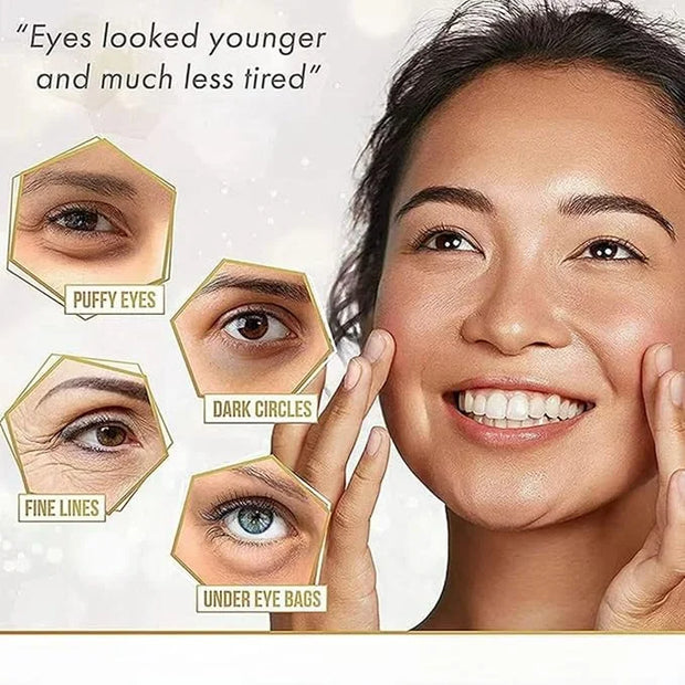 Hyaluronic Acid Eye Patch (Removes Dark Circles, Eye Bags, Eye Care, Wrinkles, Puffy Eyes, Skin Cushioning) - Anti-Aging M...