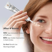 Caffeine Eye Cream for Dark Circles, Puffiness & Puffy Bags - Under Eye Serum with Caffeine, Niacinamide, Hyaluronic Acid,...