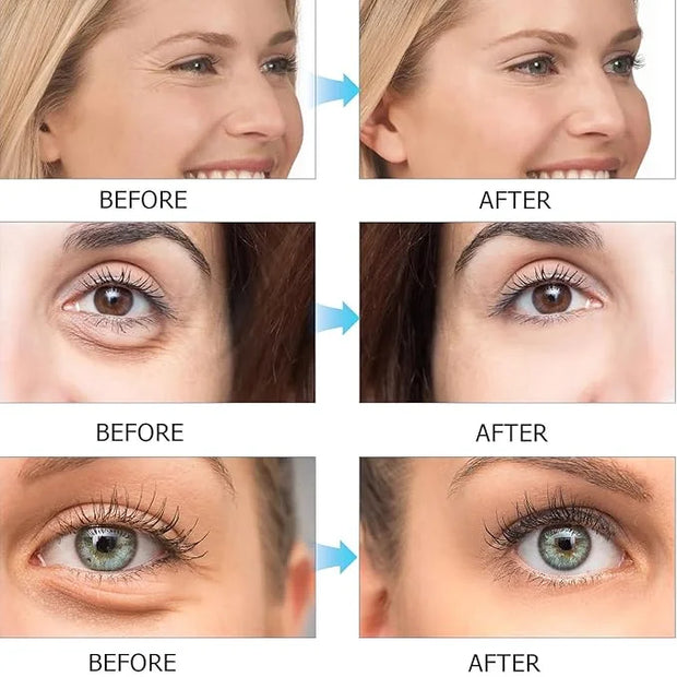 Under Eye Patch for Dark Circles and Puffy Eyes,Under Eye Masks Reduce Smooth Wrinkles and Under-eye Egg,Moisturizing Unde...
