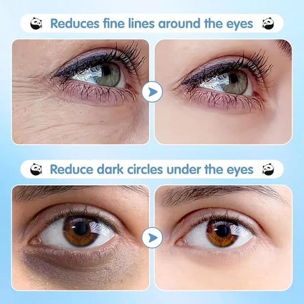 Under Eye Patches for Dark Circles, Puffy Eyes & Wrinkles - 60 Pairs Hydrating Eye Mask with Hyaluronic Acid, Blueberry Ex...