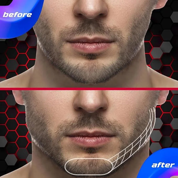 Jaw Exerciser for Men & Women 3 Levels 6 Pcs - Product Image