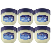Vaseline Lip Therapy 6-Pack – Mini Lip Balm, Travel-Size Petroleum Jelly Moisturizer for Dry Lips, 0.25 Oz Each - Product ...