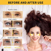 24K Gold Eye Masks for Dark Circles and Puffiness 70PCS, Under Eye Patches Gel Pads for Puffy Eyes Treatment w/Collagen, C...