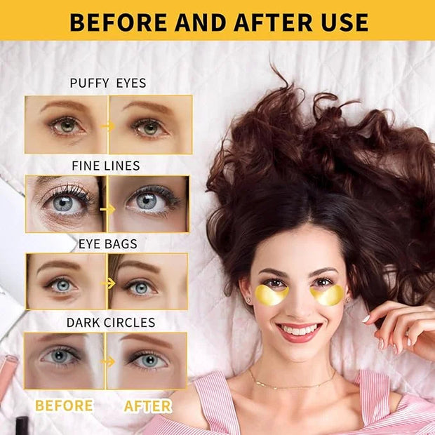 24K Gold Eye Masks for Dark Circles and Puffiness 70PCS, Under Eye Patches Gel Pads for Puffy Eyes Treatment w/Collagen, C...