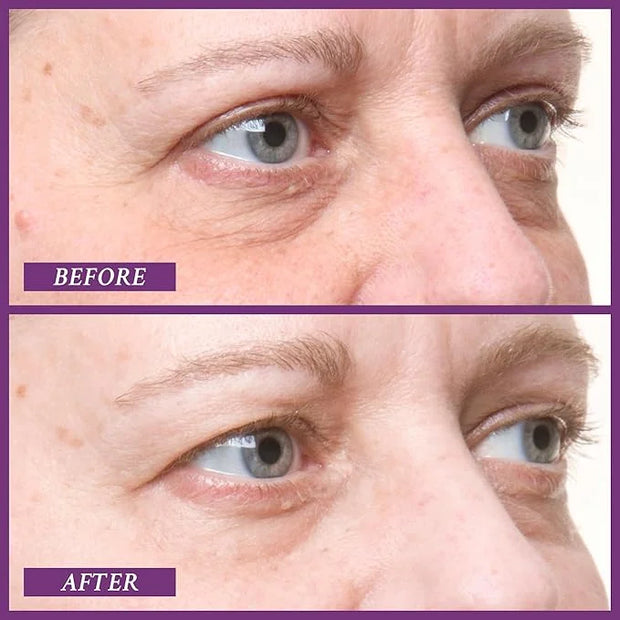 PRAI Beauty Ageless Eye D-Crease, Anti-Aging Eye Cream for Instantly Ageless-Looking Eyes, Under Eye Cream - Product Image