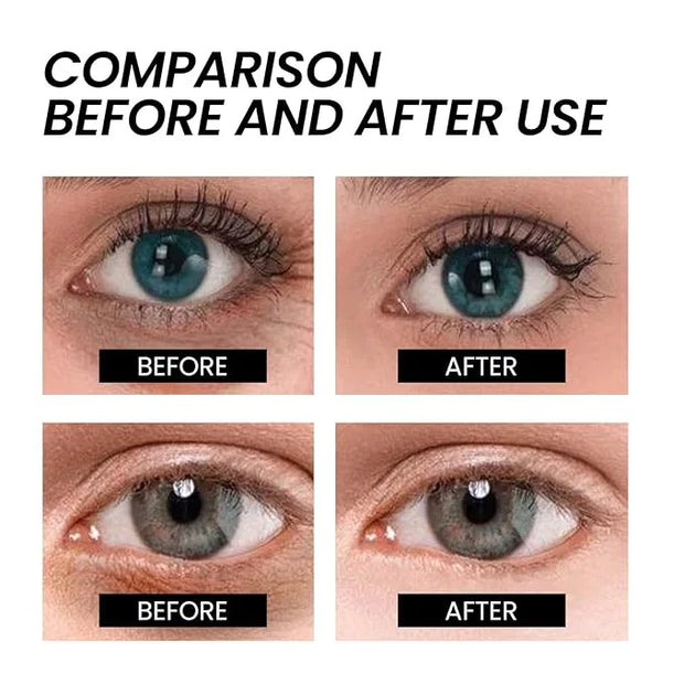 Anti-Aging Eye Cream - Instant Firming Treatment Reduces Under Eye Bags - Product Image