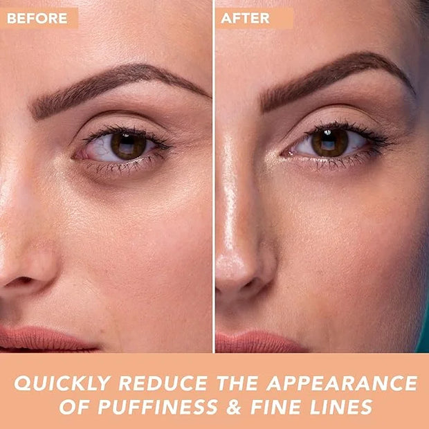 Hyaluronic Acid Eye Cream - USA Made with Natural & Organic Ingredients, Cooling Under Eye Gel & Brightener, Dark Circles ...