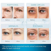 Under Eye Patches for Dark Circles: Under Eye Mask for Wrinkles - Eye Bags - Fine Lines - Puffy Eyes - Gel Mask - Amino Ac...