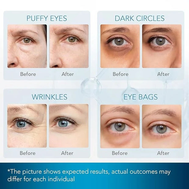 Under Eye Patches for Dark Circles: Under Eye Mask for Wrinkles - Eye Bags - Fine Lines - Puffy Eyes - Gel Mask - Amino Ac...