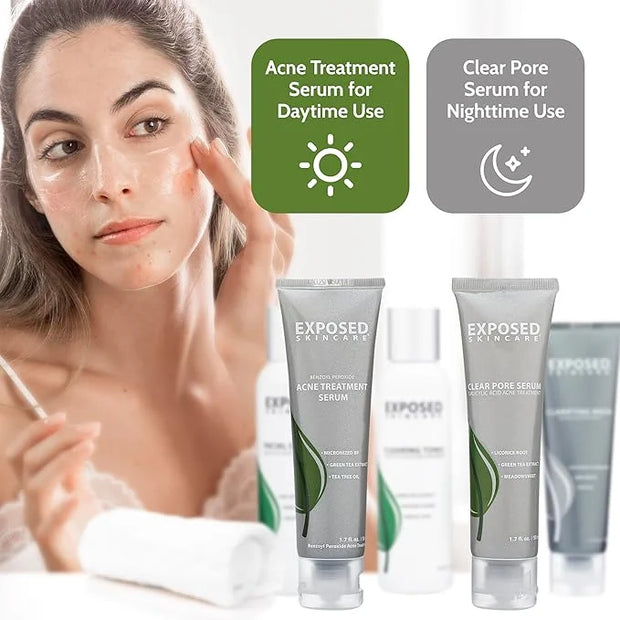 Exposed Skin Care Acne Treatment Kit - Includes Facial Cleanser, Clearing Tonic, Acne Treatment Serum, Clear Pore Serum, C...