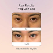 Solawave Eye Recovery Pro | FDA Cleared Red and Infrared Light Therapy for Under-Eye Wrinkles, Forehead Lines, 11s, Crow's...