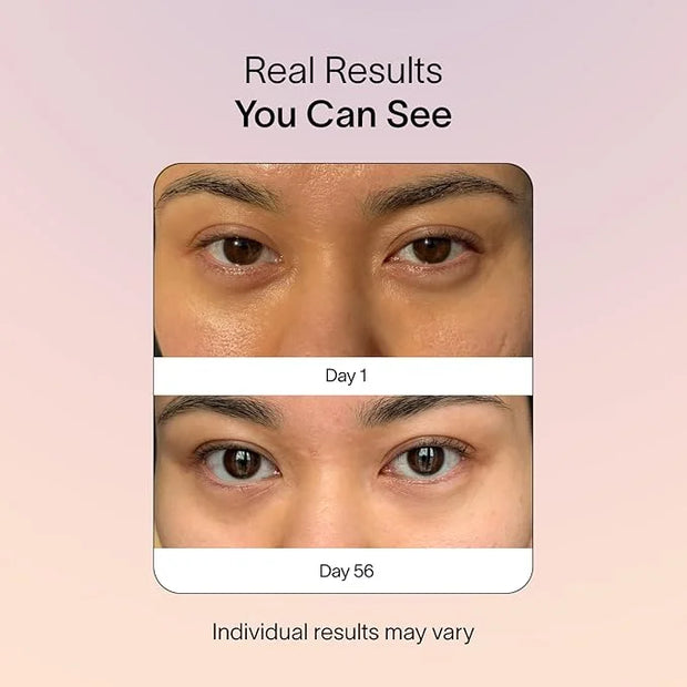 Solawave Eye Recovery Pro | FDA Cleared Red and Infrared Light Therapy for Under-Eye Wrinkles, Forehead Lines, 11s, Crow's...
