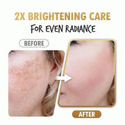 Brightening Shot Serum | Skin Brightening Serum for Face | Organic Face Moisturizer Hyperpigmentation Serum | Hydrating Fa...