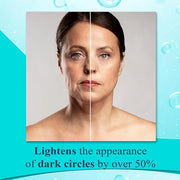 Elite Serum Rx - Anti Aging Under Eye Serum for Dark Circles and Puffiness with 7 Patented Peptides - Extra Strength Eye L...