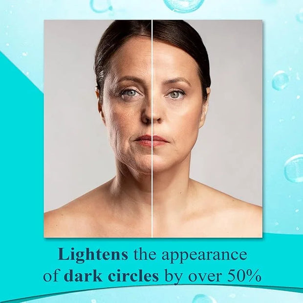Elite Serum Rx - Anti Aging Under Eye Serum for Dark Circles and Puffiness with 7 Patented Peptides - Extra Strength Eye L...
