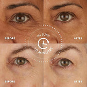 skyn ICELAND Hydro Cool Firming Under Eye Patches. Eye Gel Mask to Firm And Reduce Wrinkles, Fine Lines, Dark Circles, Puf...
