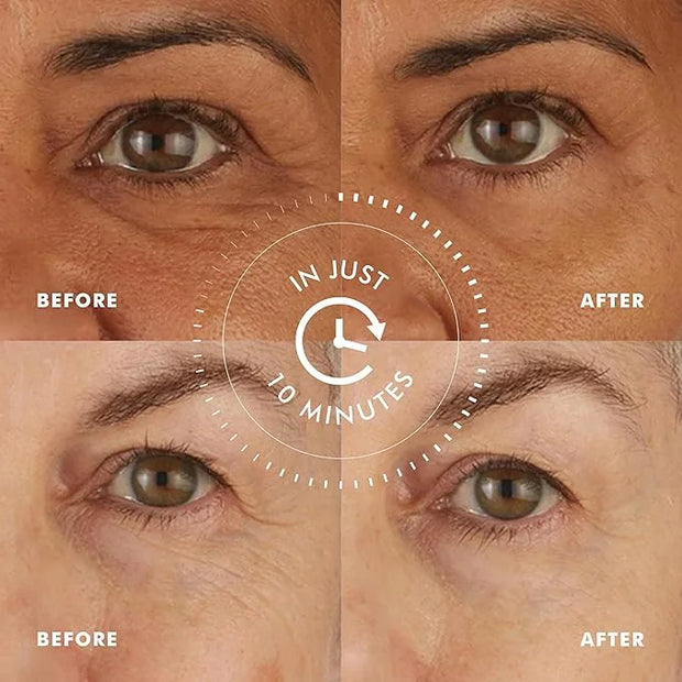 skyn ICELAND Hydro Cool Firming Under Eye Patches. Eye Gel Mask to Firm And Reduce Wrinkles, Fine Lines, Dark Circles, Puf...