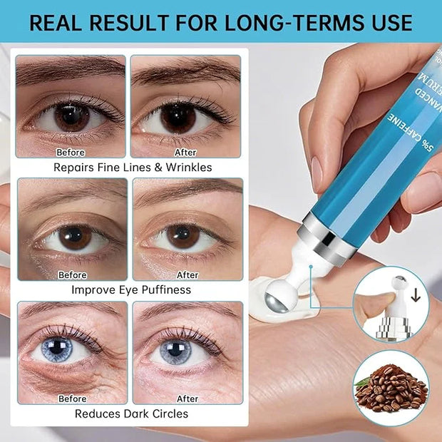5% Caffeine Eye Cream Anti Aging, Eye Cream For Puffiness & Bags Under Eyes, 2 PCS Caffeine Eye Serum With Under Eye Rolle...
