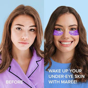 MAREE Eye Gels 2 PACK - Under Eye Patches for Puffy Eyes and Dark Circles with Natural Marine Collagen & Hyaluronic Acid -...