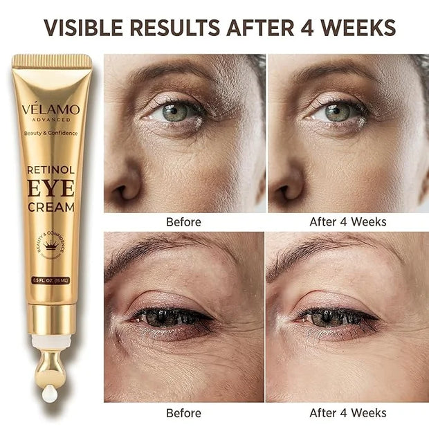 Instant Eye & Face Lift Cream: Rapid Under Eye Bags Wrinkle Smile Lines Forehead Lines Remover - Temporary Firming & Tight...