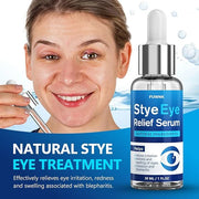 Stye Eye Treatment Serum, Eye Stye Remover for Chalazion, Blepharitis & Stye Removal, Natural Stye Eye Drops, Safe & Fast ...