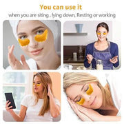 MOND'SUB Under Eye Mask - 6 Pairs Banana Crystal Eye Mask - Puffy Eyes & Dark Circles Treatments with Hyaluronic Acid, Red...