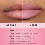 Forget the Filler Lip Plumping Line Smoothing Gloss - Daisy Girl - Premium Volumizing Lip Gloss with Natural Ingredients D...