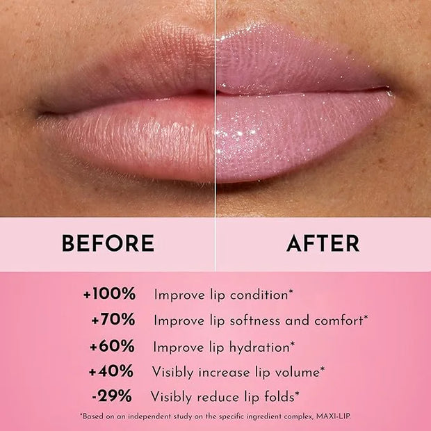 Forget the Filler Lip Plumping Line Smoothing Gloss - Daisy Girl - Premium Volumizing Lip Gloss with Natural Ingredients D...
