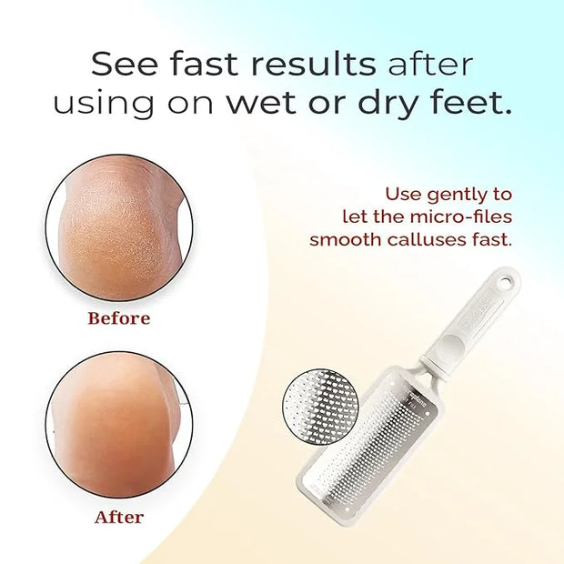 Microplane Colossal Foot File Scraper - The Original Stainless Steel Foot Rasp, Dead Skin/Callus Remover for Feet, Gentle ...