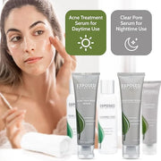 Exposed Skin Care Expanded Acne Treatment Kit - Includes Salicylic Acid Face Wash, Clearing Tonic, Treatment Serum with Be...