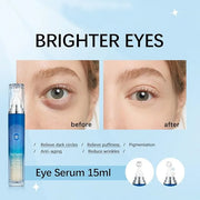 5% Caffeine Eye Serum with 360° Massage Rollerball Topper,Caffeine Eye Cream for Dark Circles,Wrinkles,Puffiness and Fine ...