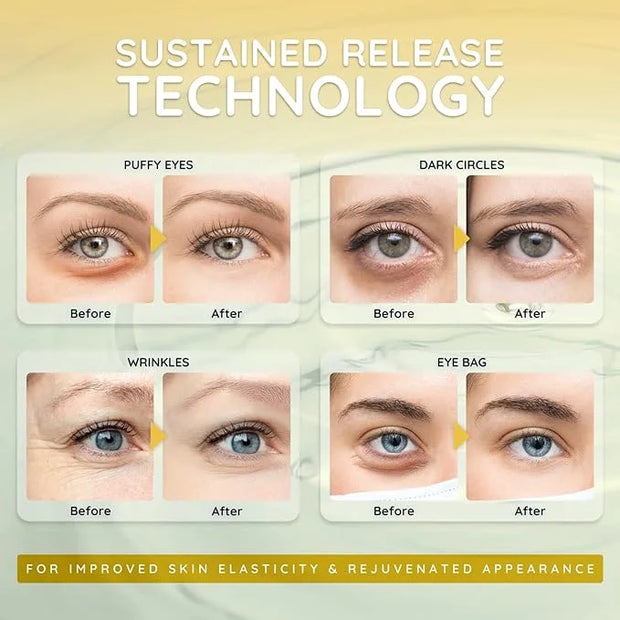 Enaskin Naturals Under Eye Patches for Dark Circles: Premium Gels Pads - Reduce Eye Bags, Wrinkles & Puffy - Skin Treatmen...