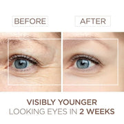 BEE and YOU Eye Serum, Anti Aging, Anti Wrinkle Serum 100% Natural with Bee Venom, Propolis Extract, Raw Honey, Hyaluronic...