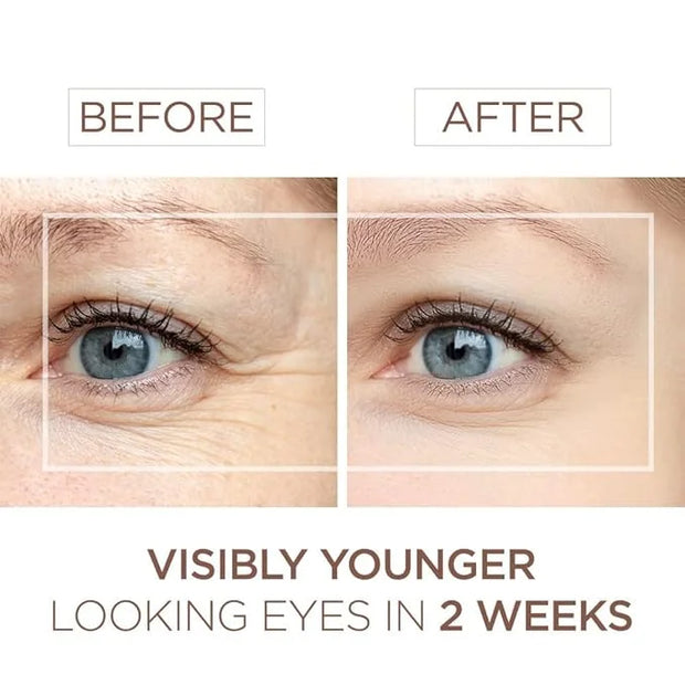 BEE and YOU Eye Serum, Anti Aging, Anti Wrinkle Serum 100% Natural with Bee Venom, Propolis Extract, Raw Honey, Hyaluronic...