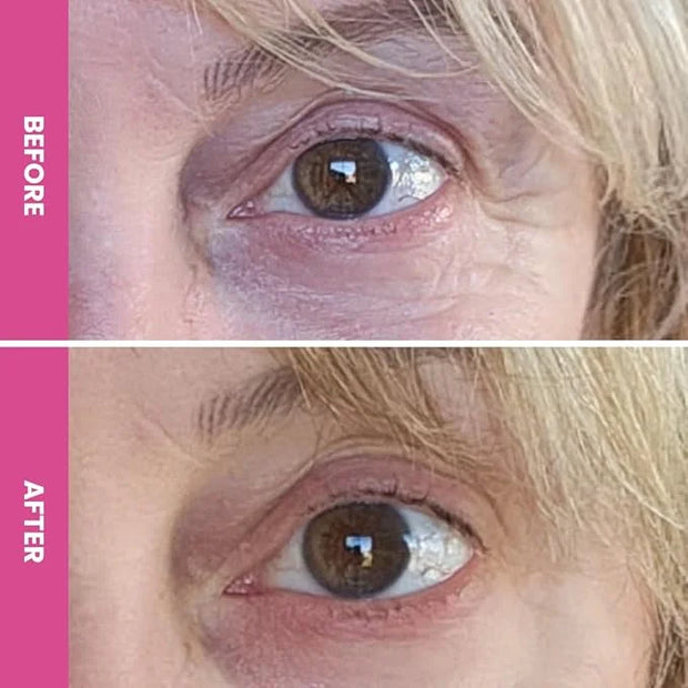 PrimeEyes Hydrate Under Eye Cream for Mature Women – Hydrating Eye Cream for Dark Circles and Wrinkle Repair – Soft, Glowi...