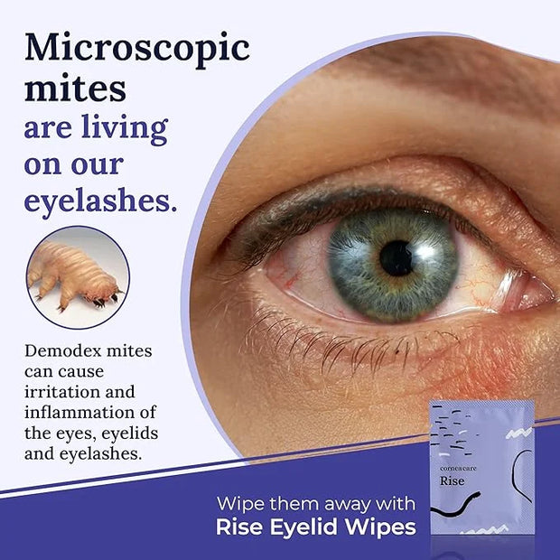 The Eyelid Hygiene Foundation | Self Heating Warm Compress for Eyes | Eye Wipes for Dry Eyes | Eye Compress for Puffy Eyes...