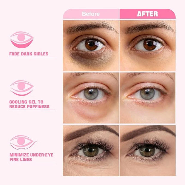 ZealSea Under Eye Patches for Puffy Eyes and Dark Circles (Collagen, 20pairs), Anti-wrinkle Patches, Eye Bags Remover for ...