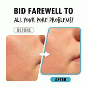 Pore Refining Serum | Pore Minimizing Serum for Face | Organic Face Moisturizer Pore Tightening Serum | Hydrating Face Ser...
