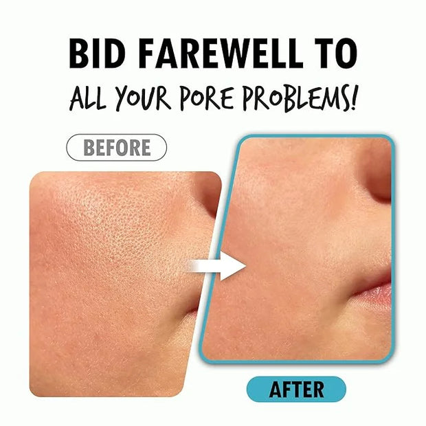 Pore Refining Serum | Pore Minimizing Serum for Face | Organic Face Moisturizer Pore Tightening Serum | Hydrating Face Ser...