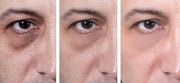 Eye Gel, for Dark Circles, Puffiness, Wrinkles, Skin Firming and Bags - Effective Anti-Aging Eye Gel for Under and Around ...