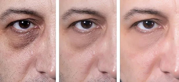 Eye Gel, for Dark Circles, Puffiness, Wrinkles, Skin Firming and Bags - Effective Anti-Aging Eye Gel for Under and Around ...
