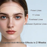 Forehead Wrinkle Patches, 15 PCS Face Tape for Wrinkles, Kinesiology Tape for Face, Facial Myofascial Lift Tape for Frown ...