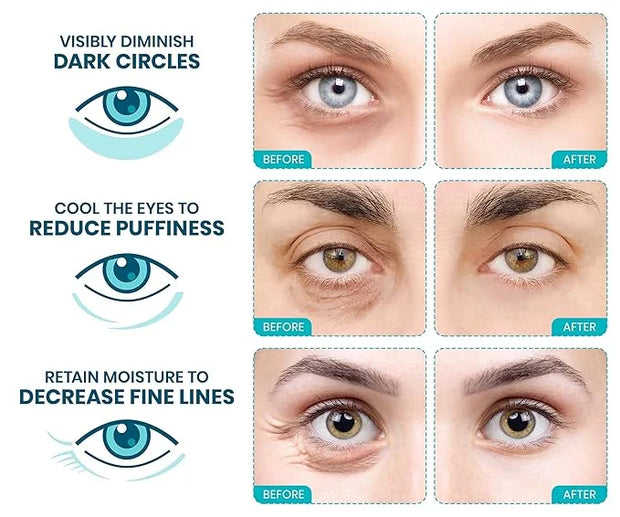 Stylia Under Eye Patches for Puffy Eyes and Dark Circles (12 Pairs) - Marine Collagen Under Eye Mask with Vitamin C, Hyalu...