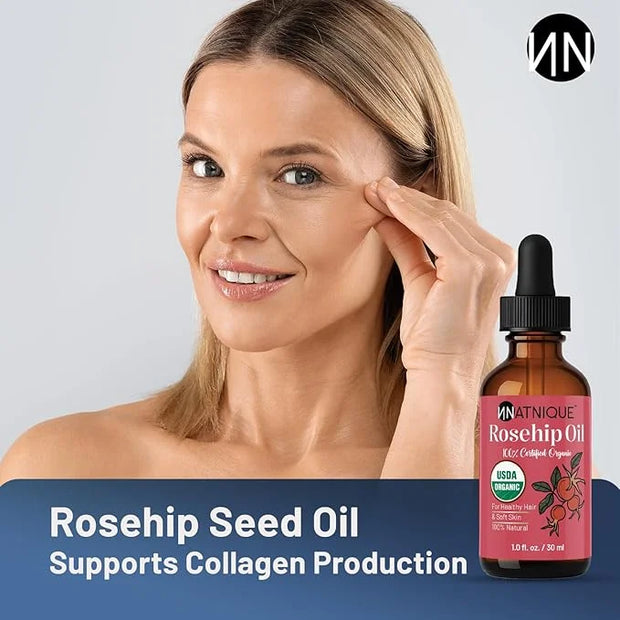 Rosehip Seed Oil Organic 1oz, USDA Certified, 100% Pure Rosehip Oil for Face, Hair & Skin. Cold Pressed Natural Moisturize...