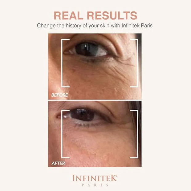 Infinitek Paris Multi-Active Collagen Eye Cream; Retinol Serum Contour - Anti Aging Eye Cream for Wrinkles, Under Eye Trea...
