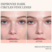 KYDA Mineral Sunscreen Eye Cream, 3-in-1 Anti-Aging Eye Cream, SPF 35, for Dark Circle and Fine Lines, Pink - Product Image